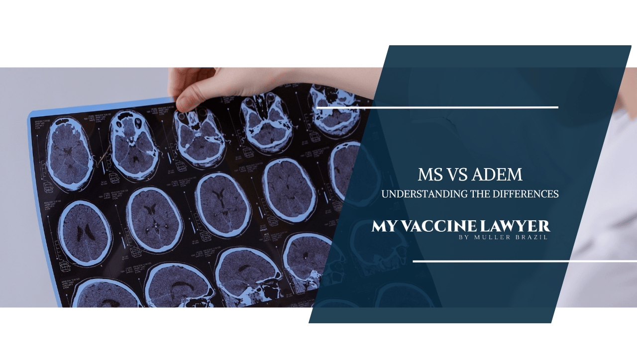 Featured image for a blog explaining 'ADEM vs MS', with brain scan images indicating differences in lesions, by MY VACCINE LAWYER.