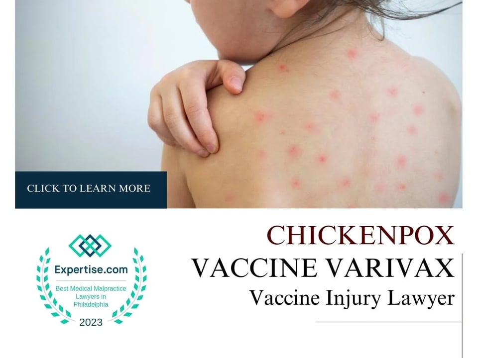 Blog featured image of a woman with red spots on her back and a caption that says “Chickenpox vaccine varivax