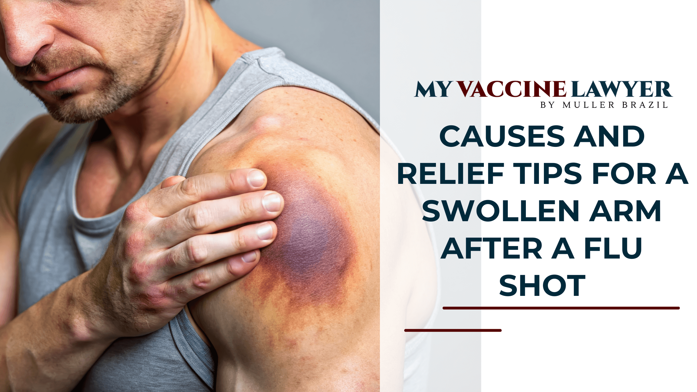 Causes and Relief Tips for a Swollen Arm After a Flu Shot